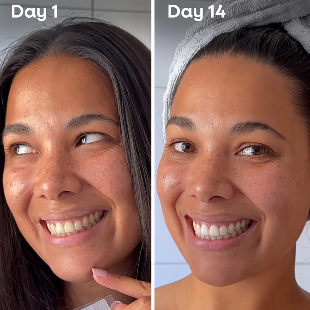 The Humble Co. Fresh Mint Whitening Strips