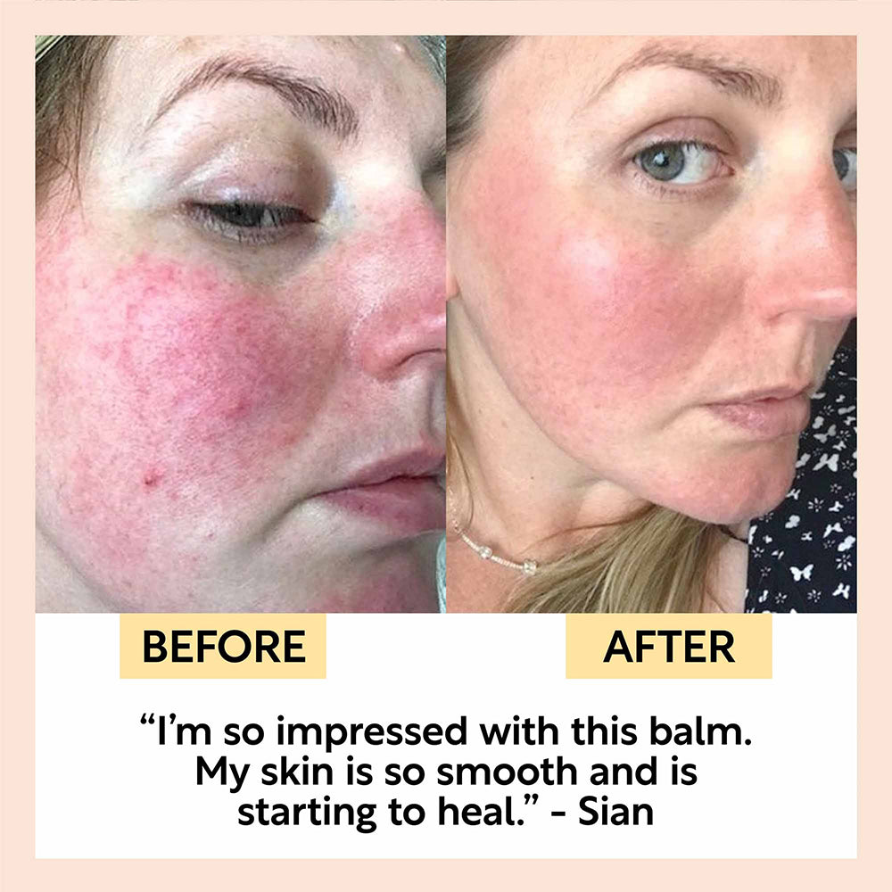 Upcircle Cleansing Face Balm with Vitamin E