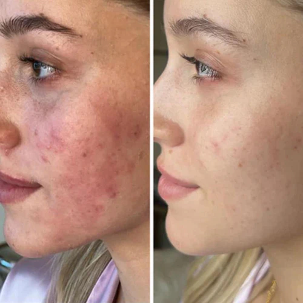 The Gaia Shower Filter - Silver skin before and after