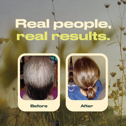 Annutri Grow It Scalp Oil