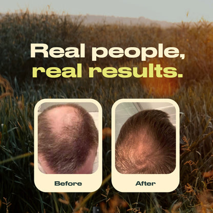 Annutri Grow It Scalp Oil