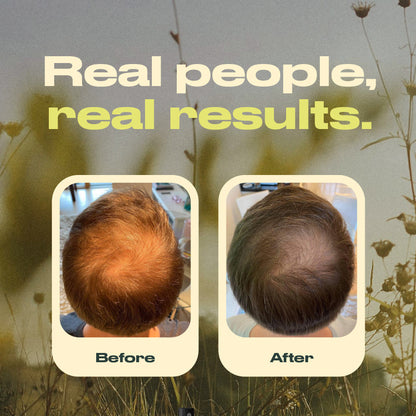 Annutri Grow It Scalp Oil