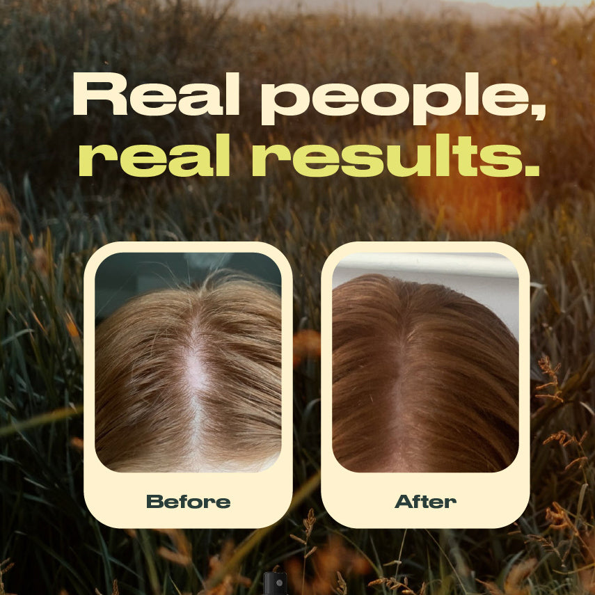 Annutri Grow It Scalp Oil