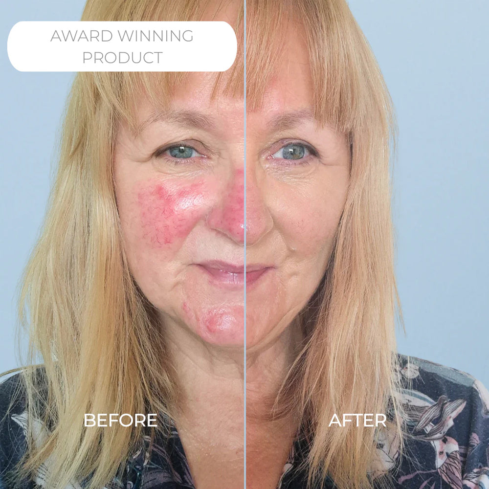 Rosalique 3 in 1 Anti-Redness Miracle Formula SPF50