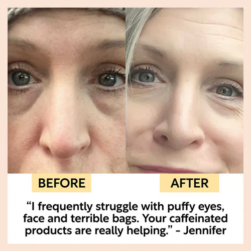 Before and after comparison of a woman&