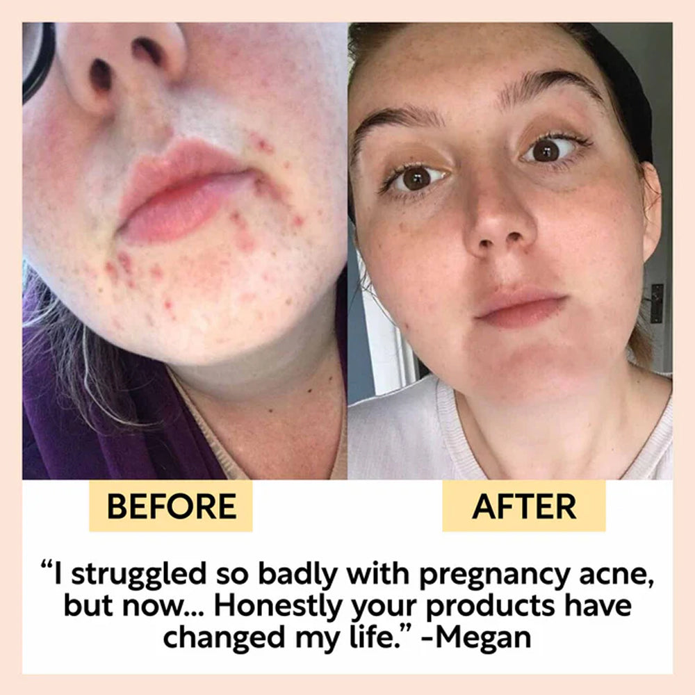 UpCircle Face Moisturiser With Vitamin E &amp; Aloe Vera