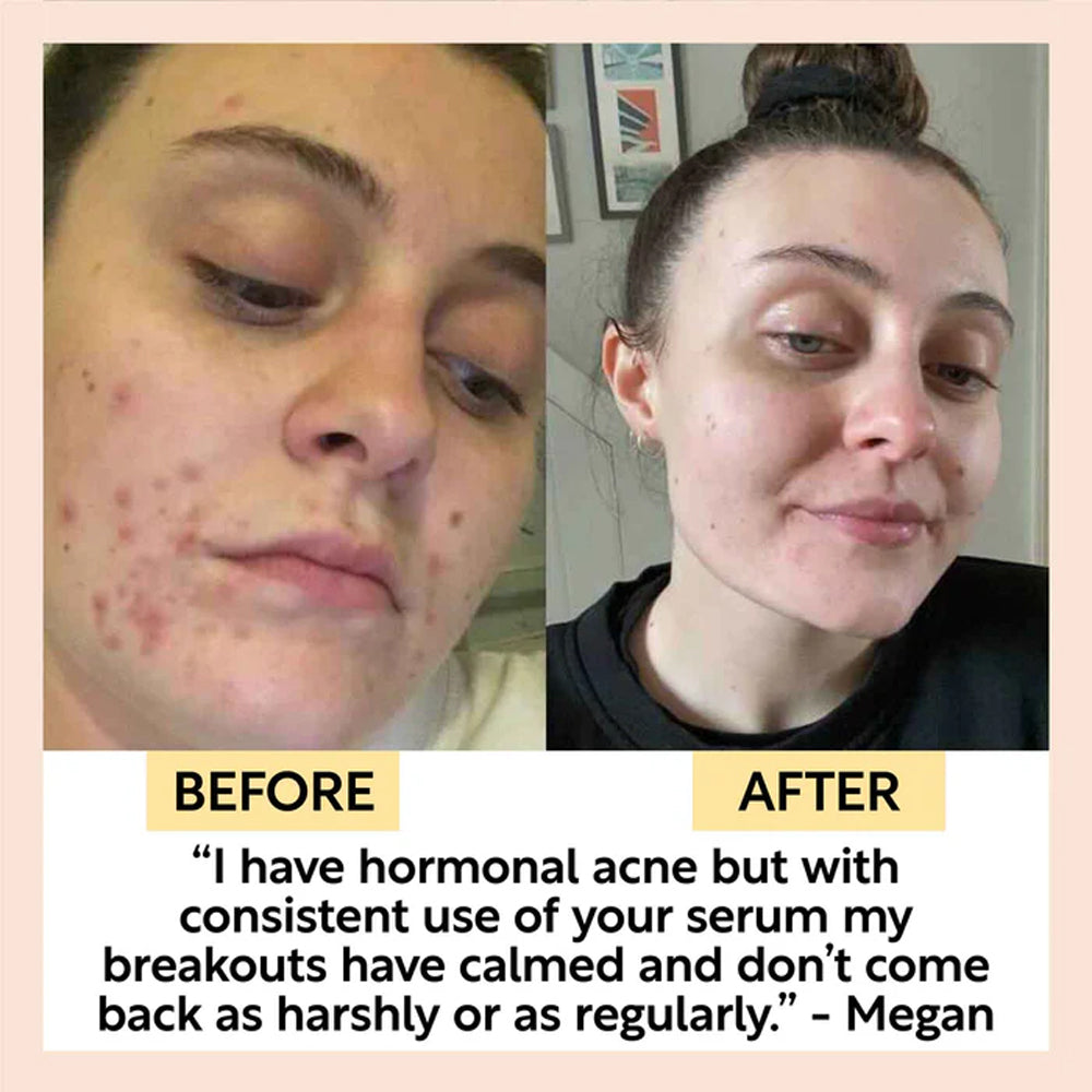 UpCircle Face Oil With Coffee, Rosehip &amp; Jojaba