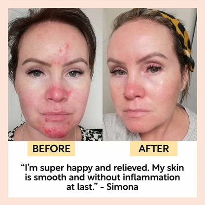 Before and after comparison of a woman&